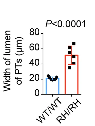 Statistic comparison of the width of lumen of PTs between in WT/WT mice (n = 7) and NUMB R632H /NUMB R632H mice (n = 6).