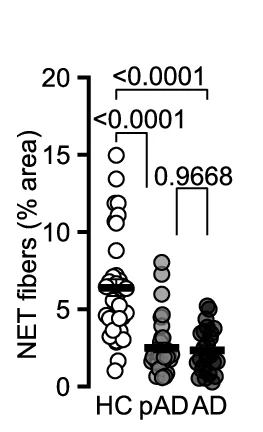 Schematic of OB in the human brain and a horizontal plane through the human brain, imaged with TSPO-PET.