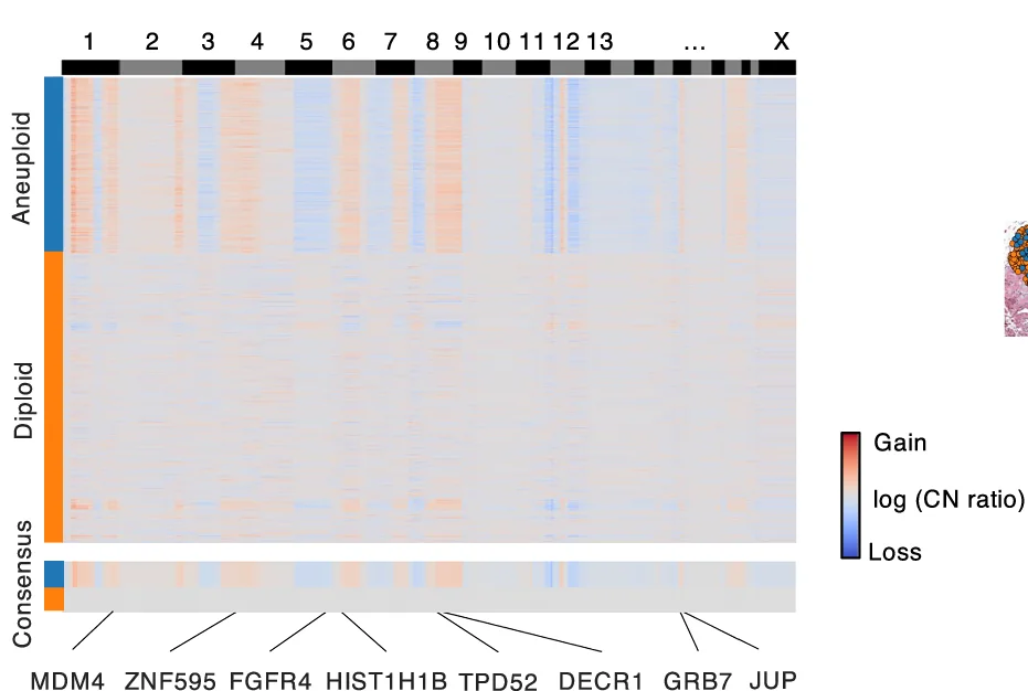 Heatmap of the copy number profiles inferred by CopyKAT based on the in silico cell-level transcriptome predicted by Thor. Representative breast cancer-related genes are provided.