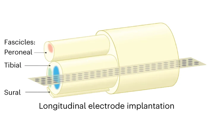 Peripheral nerve tissue response. Schematic of the intraneural biocompatibility experiment. A PI device with and without EGNITE is implanted in the tibial branch of the sciatic nerve of rats.